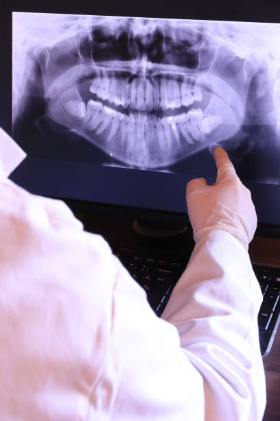 Best Emergency Tooth Extraction in Wrens, GA