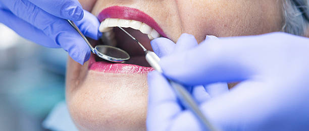 Best Emergency Treatment for Dental Infections or Abscesses in Wrens, GA